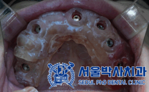 산성동치과