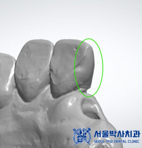 신흥동치과