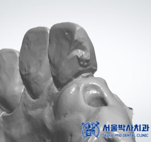 신흥동치과