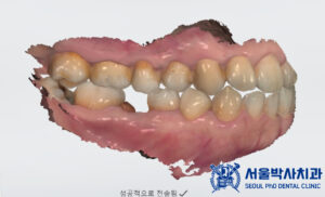 산성동치과