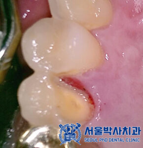 산성역치과