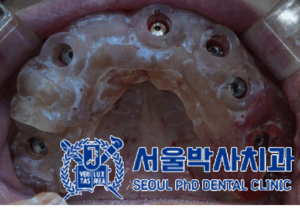 신흥동치과