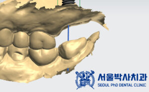 신흥동치과