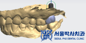 신흥동치과